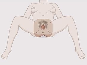 Жінка в положенні лежачи із розведеними ногами. Видимі статеві органи виділені.