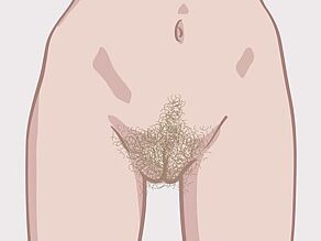 Different vulvas: example 1