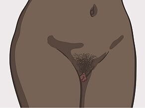 Different vulvas: example 2