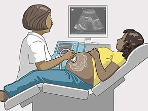 Die Ärztin/der Arzt führt während einer Schwangerschaft mindestens drei Ultraschalluntersuchungen durch.