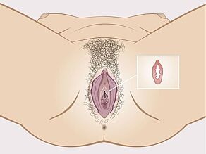 Detail van het maagdenvlies binnenin de vagina: een soepel randje huidweefsel. Het maagdenvlies is geen vlies dat de vagina afsluit.