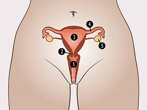 Los órganos sexuales internos de una mujer son: 1. vagina, 2. cuello uterino, 3. útero, 4. trompas de Falopio, 5. ovarios.