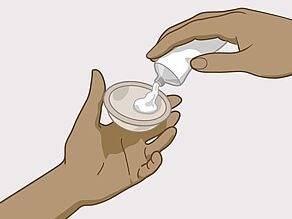 Appliquez à l’intérieur du diaphragme un gel spécial qui tue ou ralentit les spermatozoïdes.