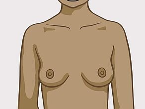أشكال مختلفة للثدي: ثدي متوسط الحجم مستدير