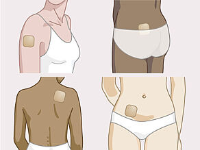 Aplicați plasturele pe abdomen, pe fesă, pe spate, pe umăr sau pe exteriorul antebrațului, pe piele curată și uscată.