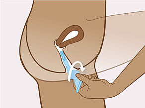 După sex, țineți de inelul exterior și răsuciți-l puțin când trageți prezervativul. 