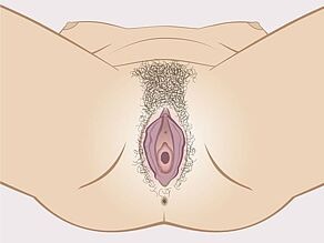 Verschillende maagdenvliezen: maagdenvlies met een middelgrote opening