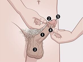 Die sichtbaren Sexualorgane des Mannes sind: 1. Penis, 2. Eichel, 3. Hodensack. Im Bereich der Eichel: 4. Vorhaut, innen: 5. Harnröhrenöffnung.