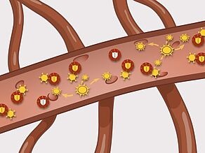 Darstellung eines Blutgefäßes im Detail mit sehr vielen HI-Viruszellen und nur sehr wenigen verbleibenden weißen Blutkörperchen. Der Körper kann sich nicht mehr gegen Infektionen wehren.