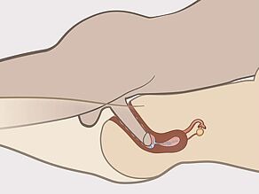 Detail van de penis in de vagina inwendig gezien. Sperma verlaat de penis en gaat binnen in de baarmoeder.
