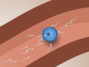 Fertilization: one sperm cell enters the egg cell and fertilizes it.