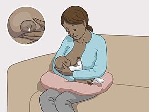 عدوى نقص المناعة المكتسبة يمكن أن تنتقل عبر لبن الثدي عند الرضاعة الطبيعية. 