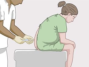 طبيب يعطي سيدة تخدير فوق الجافية (موضعياً): حقنة في أسفل الظهر لتخفيف الألم أثناء الانقباضات.