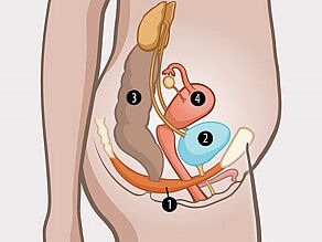 Darstellung des weiblichen Beckens im Detail: 1. Beckenbodenmuskeln, die 2. Blase, 3. Darm und 4. Gebärmutter stützen. 