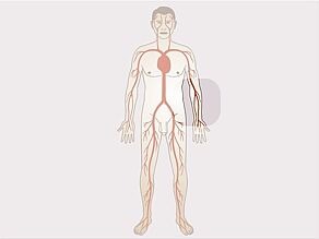 Man standing. The focus is on the blood vessels.