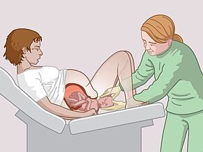 Woman giving birth to her baby.