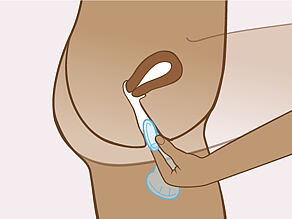 Поставете презерватива нагоре във вътрешността на влагалището. 
