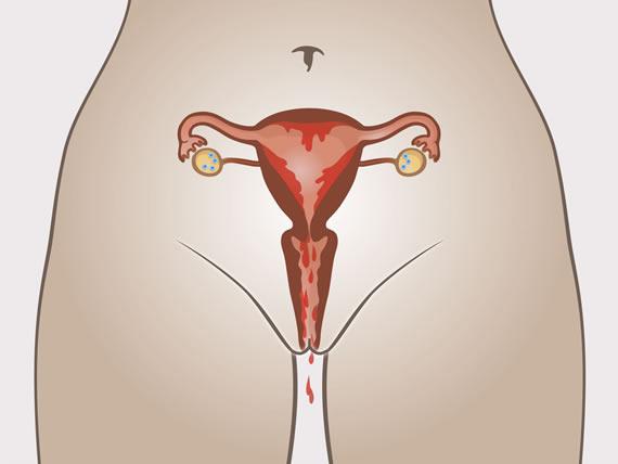 Менструация: яйцеклетка не оплодотворена. Начинается новый цикл.