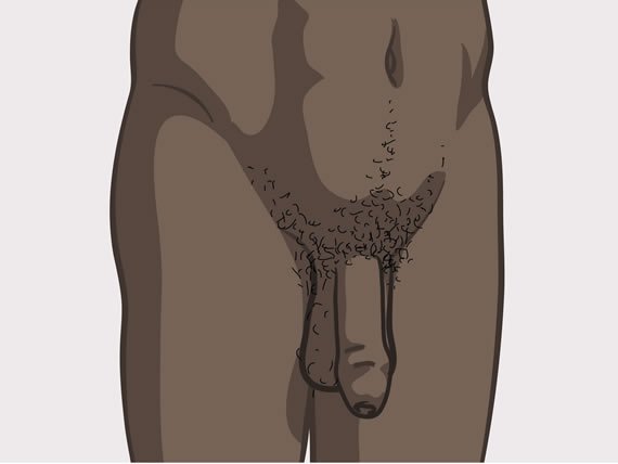 descrierea tipurilor de penisuri