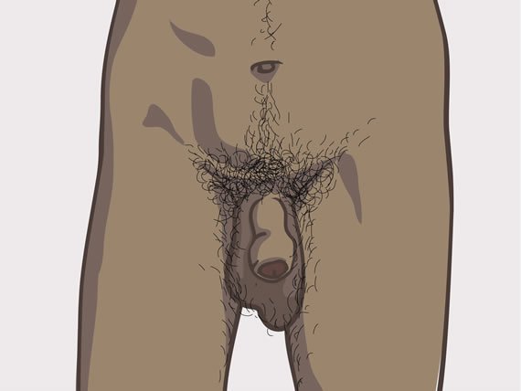 forme și tipuri de penisuri masculine)