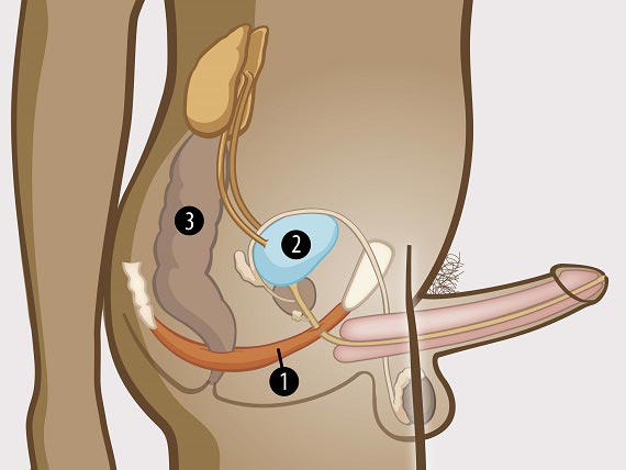Reeducare perineală UROSTIM (incontinență urinară) - OsteoKinetoMedica
