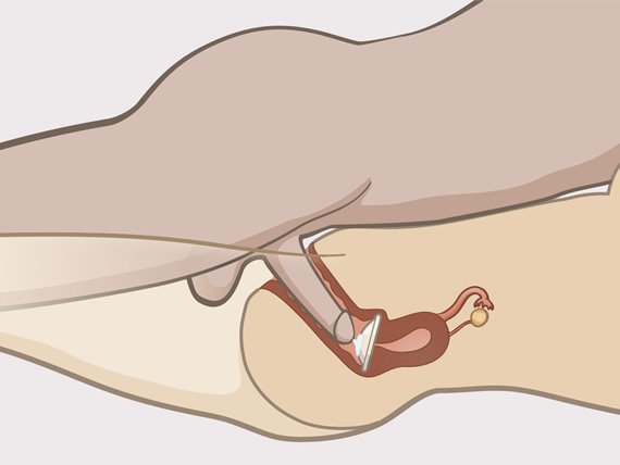 The diaphragm stays in place when having sexual intercourse. 