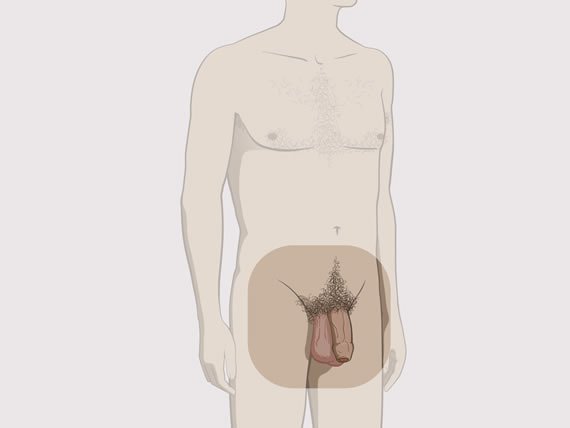 scăderea dimensiunii penisului
