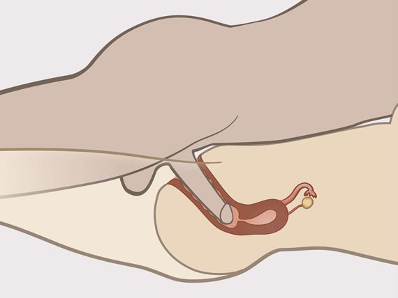 Sperma läuft aus scheide